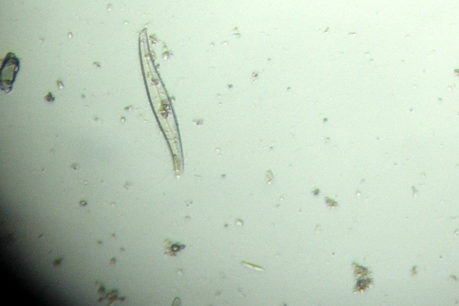 Chrysophyta o alghe giallo-dorate
